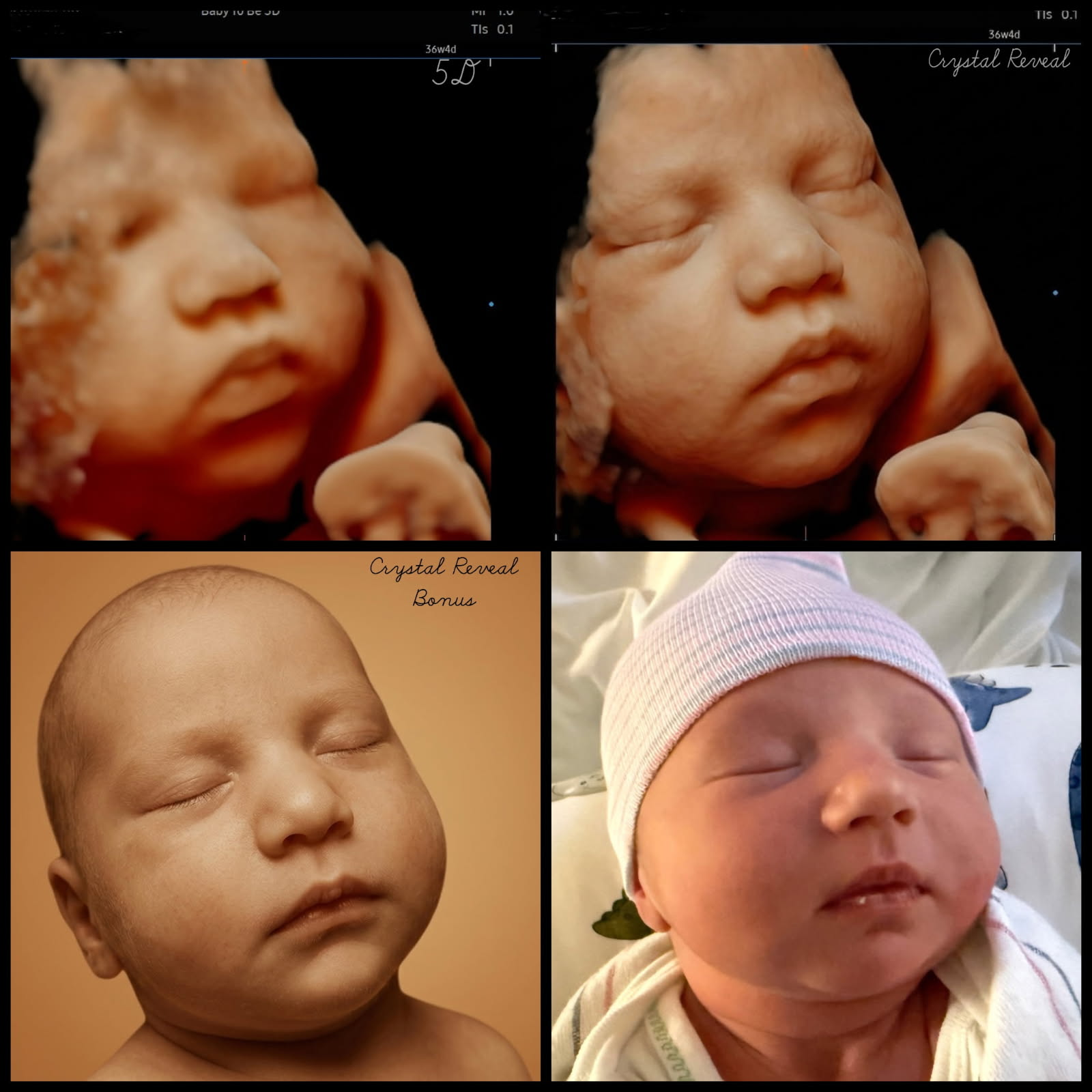 Four-tile partner-submitted comparison — original ultrasound and CrystalReveal Basic preview on the top row; CrystalReveal Bonus preview and the actual newborn photo on the bottom row.