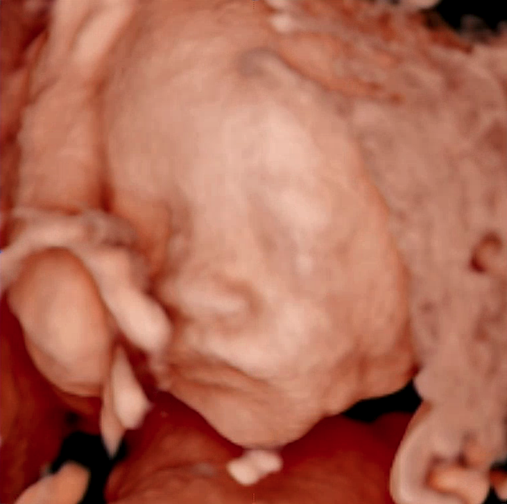 Original 3D/4D Scan
