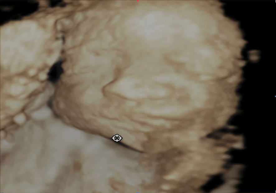Original 3D/4D Scan
