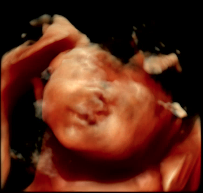 Original 3D/4D Scan