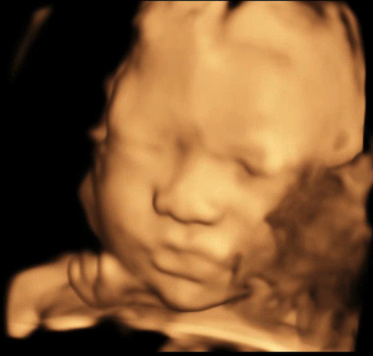 Original 3D/4D Scan