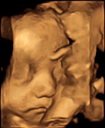 Original 3D/4D Scan