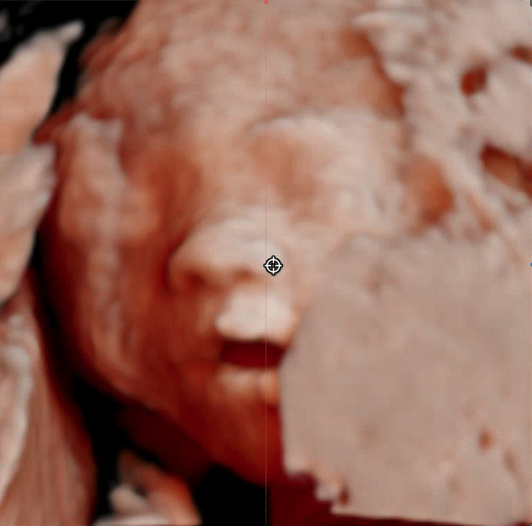 Original 3D/4D Scan