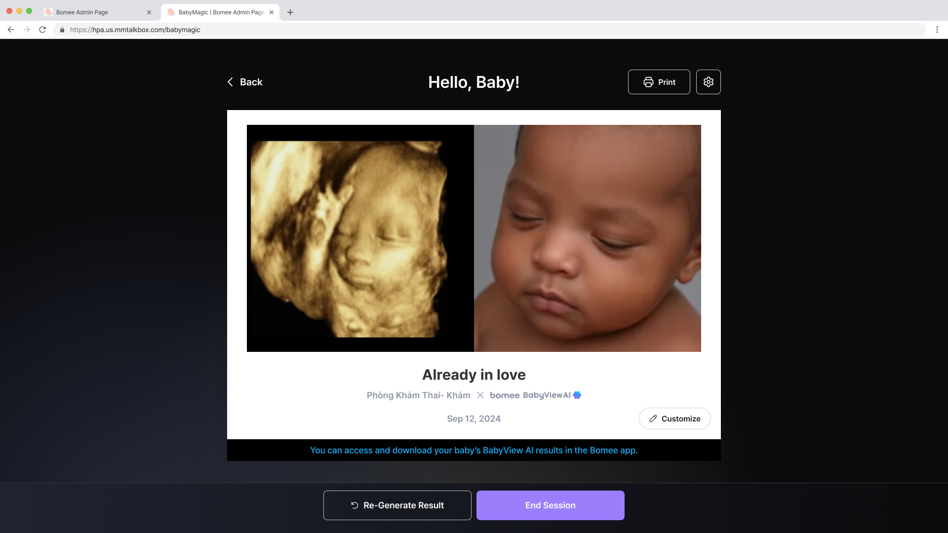 BabyView AI generation in HPA