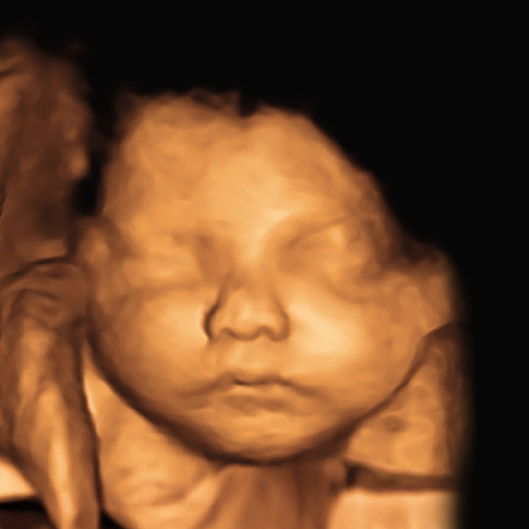 Pricing Strategy for Elective Ultrasound Packages: The Complete Guide