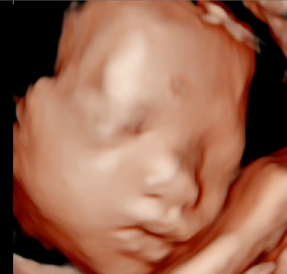 When Can You See Baby's Face on Ultrasound? A Week-by-Week Guide