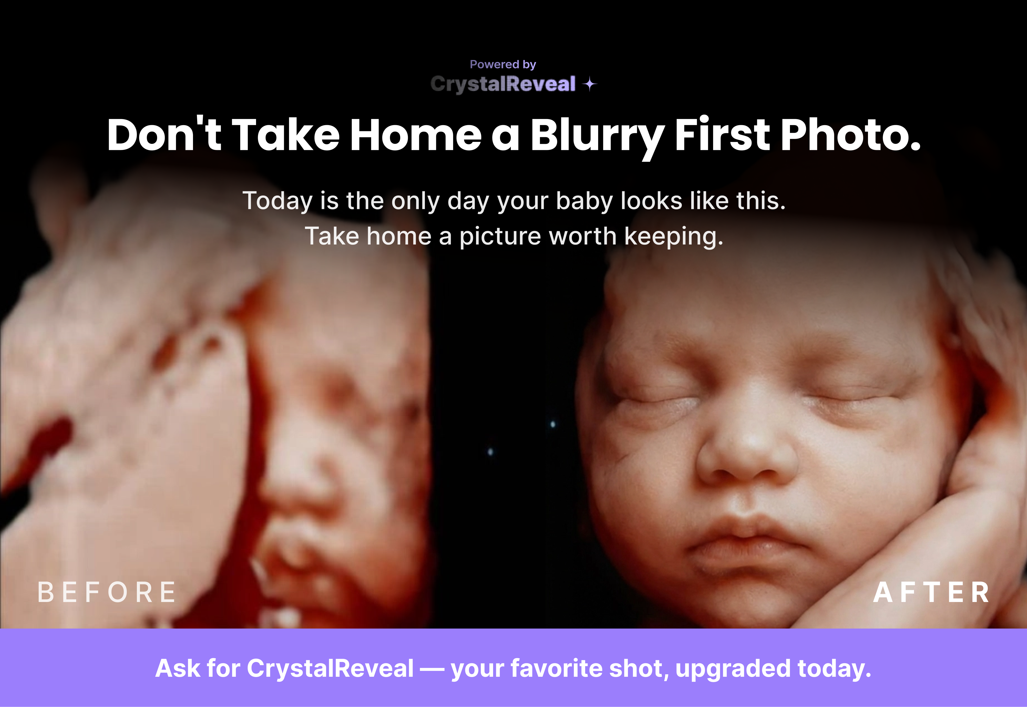 "Don't leave with just a blur" — before/after social variant